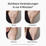 Ulike Air 2 IPL Geräte Haarentfernung für Damen und Herren mit Eiskühltechnik, nahezu schmerzfreie Ergebnisse, Sichere Alternative zur Laser Haarenentfernung, für Körper und Gesicht