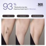 Ulike Air 3 IPL Geräte Haarentfernung für Gesicht und Körper zu Hause, Alternative zur Laserhaarentfernung, mit Saphir-Eiskühlsystem für schmerzfreie langanhaltende Ergebnisse, Lila