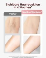 Haarlosy IPL Geräte Haarentfernung mit Kühlfunktion, 999,900 Lichtimpulse, 5 Energiestufen Schmerzfreie IPL Haarentfernung Laser Hair Removal für Frauen, Männer, Intimbereich, Körper und Beine - Rose