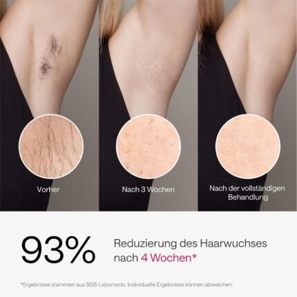 Ulike Air 3 Deluxe IPL Geräte Haarentfernung für Gesicht und Körper zu Hause, Alternative zur Laserhaarentfernung, Saphir-Eiskühl für dauerhafte haarentfernung, mit UV-Sterilisator & Aloe Gel, Lila