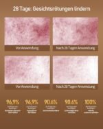 LED Maske Gesicht, Rotlicht Maske Gesicht, Vier Modi, drei Ebenen, Blaues Licht, Aufbewahrungstasche, Kopfband, Augenpolster, für Büro und Zuhause, Geschenk für Mutter, Mädchen (weiß)