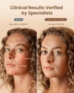 RENPHO LED-Rotlicht-Gesichtsmaske, Ein großartiges Valentinstagsgeschenke, Led Maske Gesicht Mit 324 LED-Lampen für eine umfassende Abdeckung des Gesichts, Drei Beleuchtungsmodi und kabelloses Design