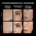 FAQ 202 Kabellose LED-Gesichtsmaske mit Reiseetui – Anti-Aging-Hautpflege mit 8 Lichteinstellungen – 600 Lichtpunkte zur Pickel-Behandlung & Gesichtspflege – Leicht, robust und reisefreundlich im Set
