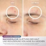 Shark CryoGlow LED Maske, Lichttherapie Maske, Kühlung der Augenpartie, Anti-Aging, Hautklärung, rote/blaue LED, Rotlichtlampe Gesicht, USB-C, Fernbedienung, Schönheitsgeschenke, Kühles Lila FW312EUPL