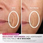 Shark CryoGlow LED Maske, Lichttherapie Maske, Kühlung der Augenpartie, Anti-Aging, Hautklärung, rote/blaue LED, Rotlichtlampe Gesicht, USB-C, Fernbedienung, Schönheitsgeschenke, Kühles Lila FW312EUPL